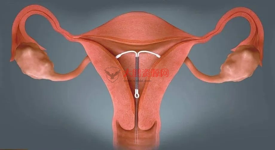 图片[4]-避孕不止安全套，17种避孕方法了解一下好兄弟们-阿勒源码网